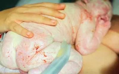 El cuidado de la piel del bebé comienza en el embarazo
